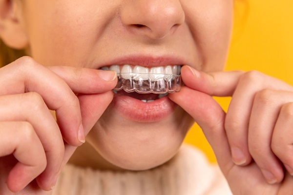 Invisalign Teeth Straightening Therapy Aftercare